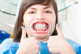 Naklejki Attractive female patient wearing retractor and thumb up