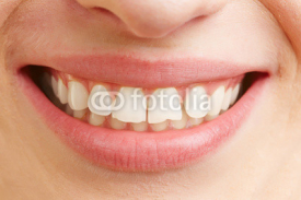 Lächelnder Mund mit weißen Zähnen